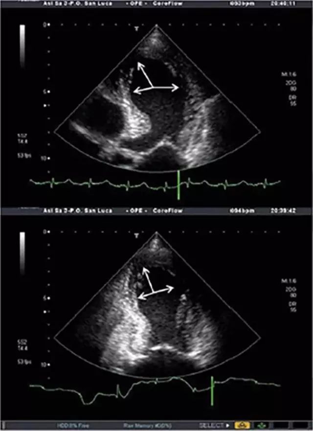 碎了的心脏,长的就和章鱼篓一样.