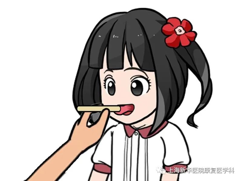 (2)舌运动控制:可采用推舌法提高舌肌肌力,配合促进舌向上,向后运动的