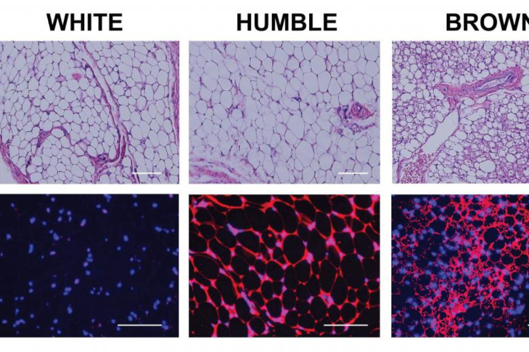 從白色脂肪到褐色脂肪脂肪移植也可治療肥胖