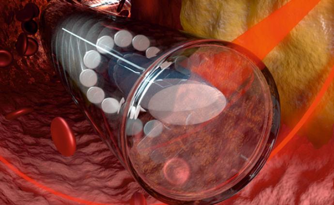 真正的“深入人心”：世界上最小的血管内窥镜