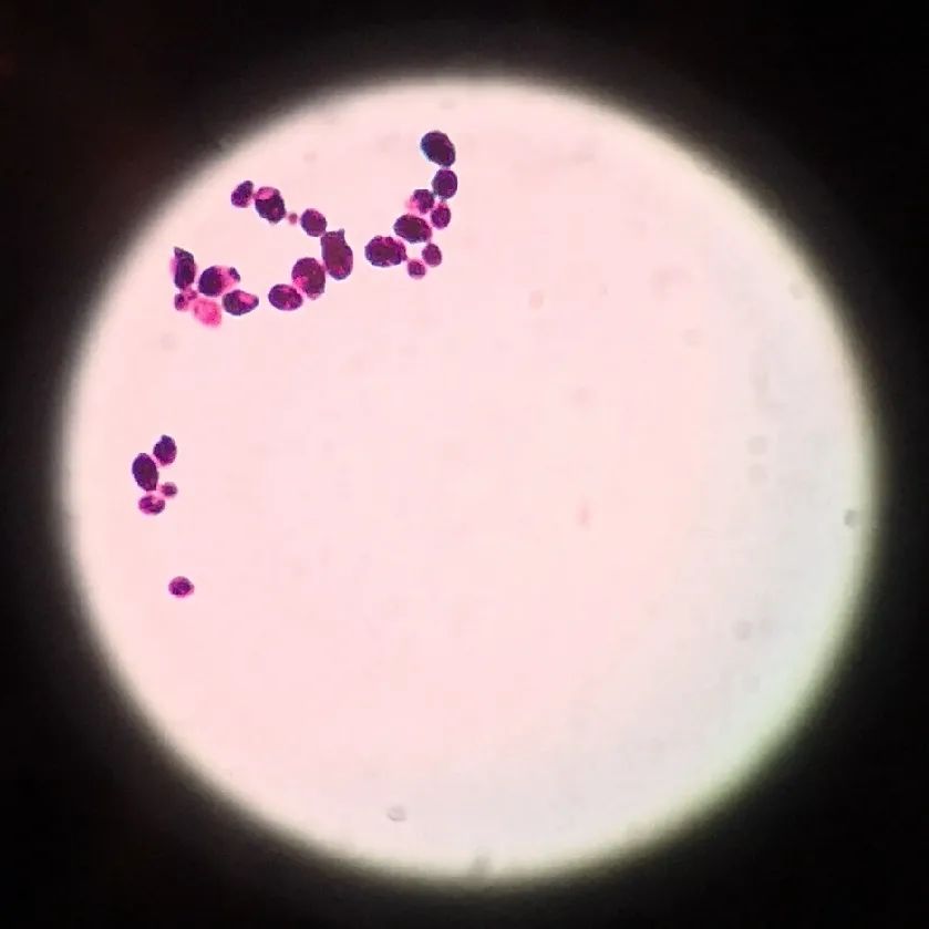 会制作特殊的细菌片,然后经过一系列的染色处理,最后在显微镜下观察
