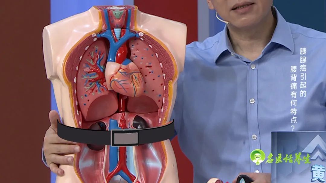 腰背疼痛 血糖波动 竟是这个 癌 惹的祸 湃客 澎湃新闻 The Paper