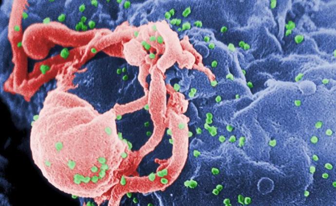 艾滋病能“自愈”？基因分析提供“精英控制者”线索