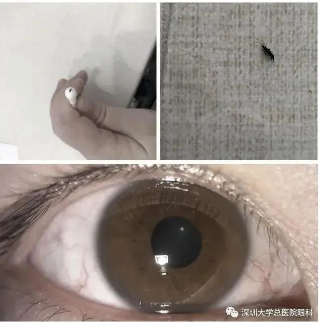 辣眼睛深圳的虫子实在太太太多了