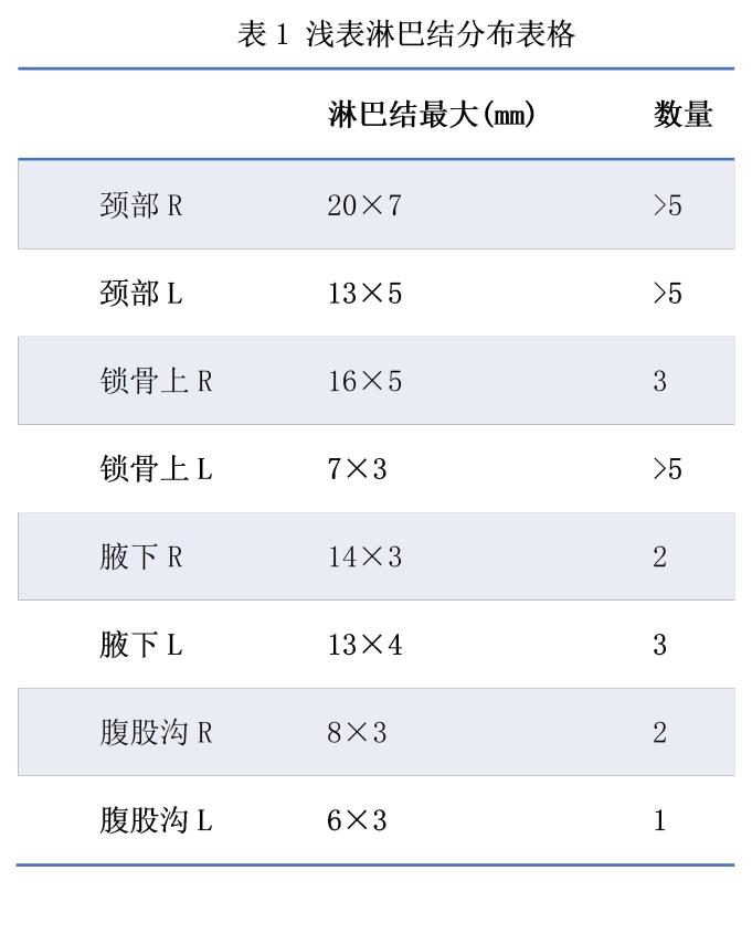 pet/ct :双侧口咽部及鼻咽部粘膜,双侧颈部,双侧锁骨上,纵隔及双肺门