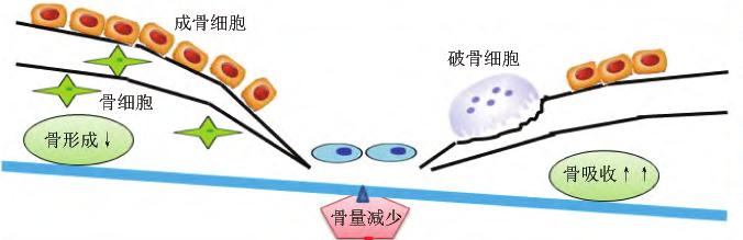 成骨分化能力下降;肌肉衰退,对骨骼的应力剌激減少,对骨代谢调节障碍