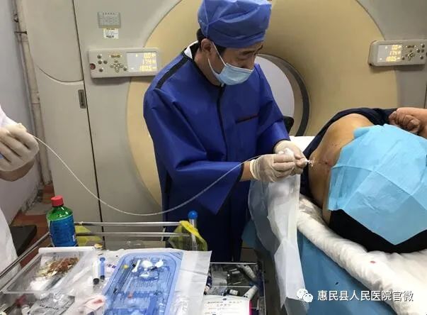 硬膜外穿刺与置管成功,可见脑脊液外流.