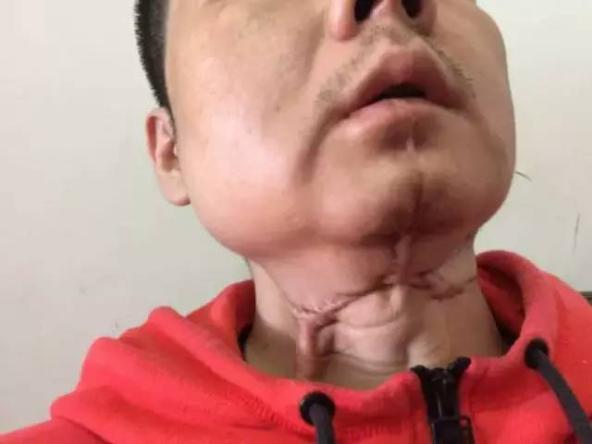 癌症阴影下,为什么还是有那么多人嚼槟榔?