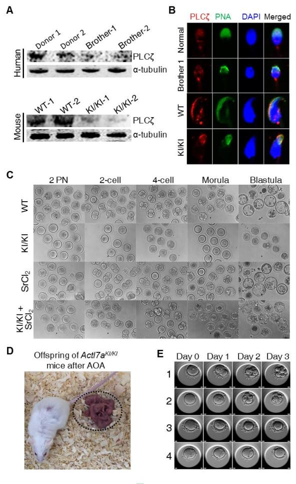 合并卵子激活(aoa),成功使得突变小鼠精子与卵子受精并发育成囊胚,经