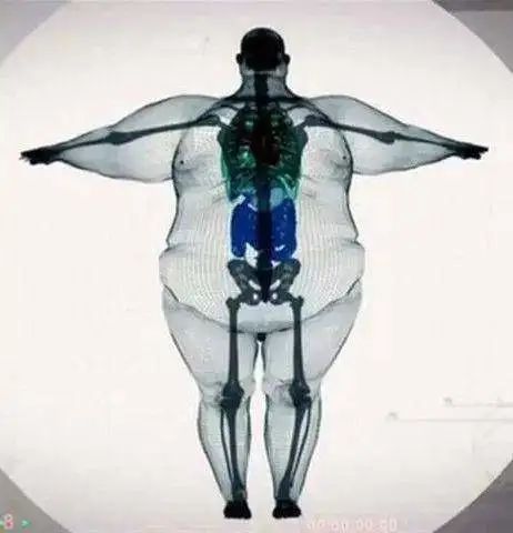 胖子的骨架搞笑图片