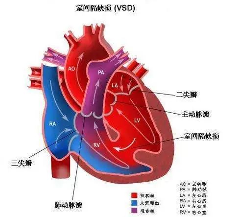 我們國家在2016年有一個專家共識,將妊娠合併心臟病分了五級,從患者的