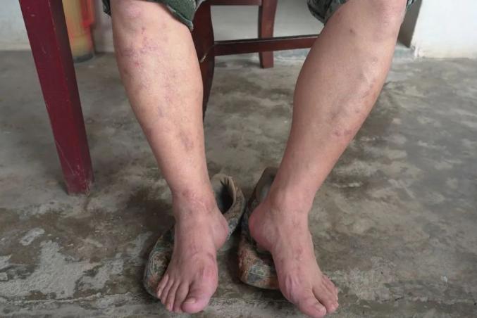 东至抗洪大脚上央视啦成为新时代最可爱的人