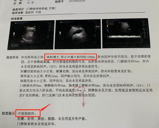 11岁男童重度肝硬化这件事比熬夜喝酒还伤肝