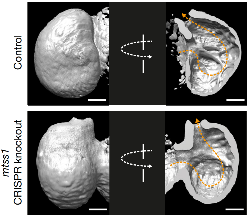 小鼠mtts1 被敲除后,小鼠心脏的心肌小梁发育受损在另外筛选出的位点