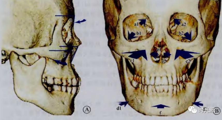 面部骨骼衰老的过程图图片