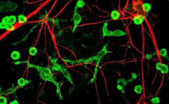 大脑免疫细胞有望成为治疗的细胞靶点