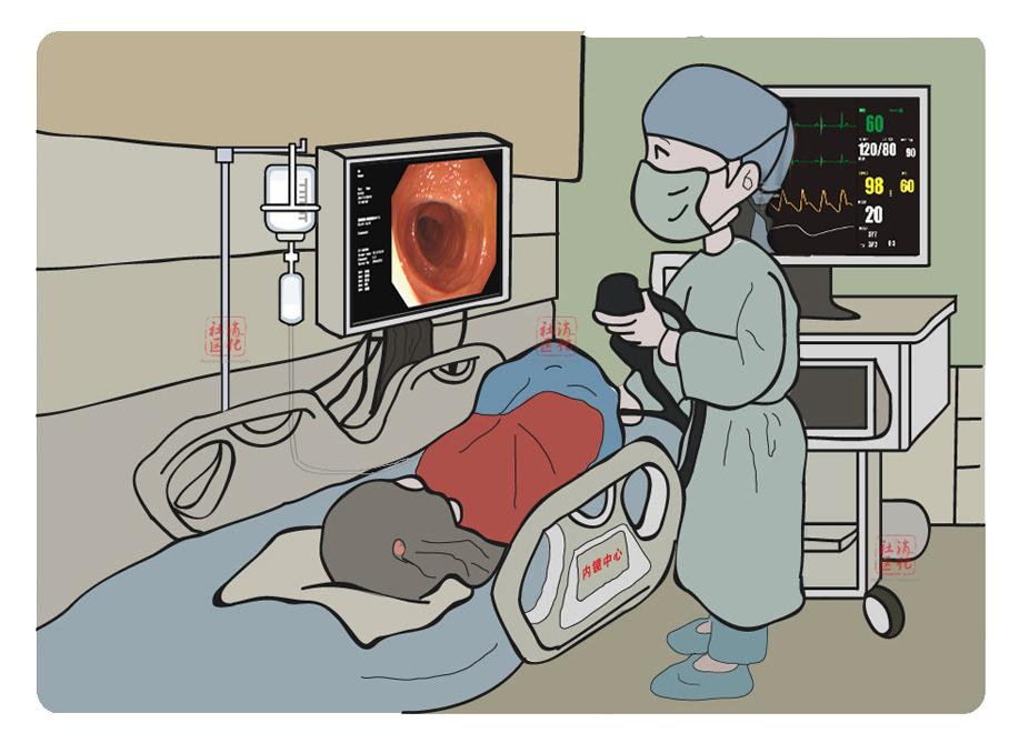 等结肠癌症状肠镜检查不可少