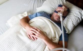 研究证实了睡眠呼吸暂停和阿尔茨海默病之间的联系