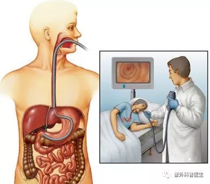 老胃病天天犯 怎么判断胃病有多严重 老胃病天天犯 怎么判断胃病有多严重