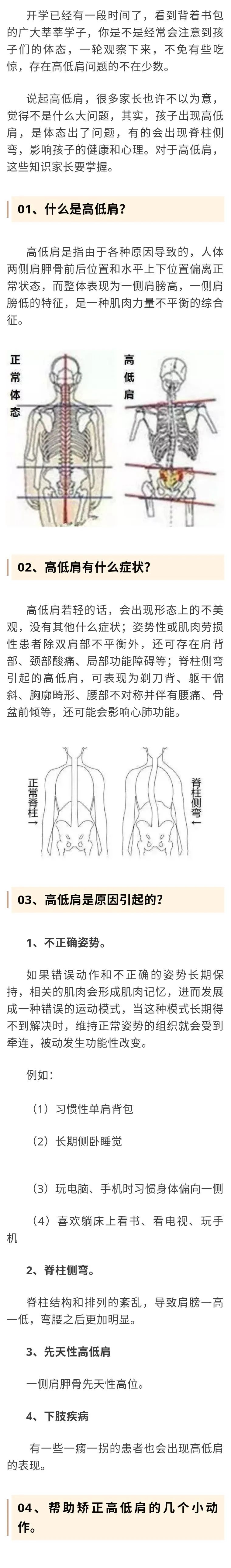 高低肩危害原来这么大5个动作助你矫正