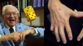 經常掰指關節(jié)會導致關節(jié)炎嗎？｜世界關節(jié)炎日