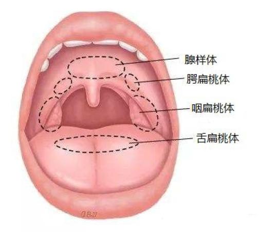 腭扁桃体图片