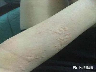 不是所有毛毛虫都会变蝴蝶,但是它们都会刺人