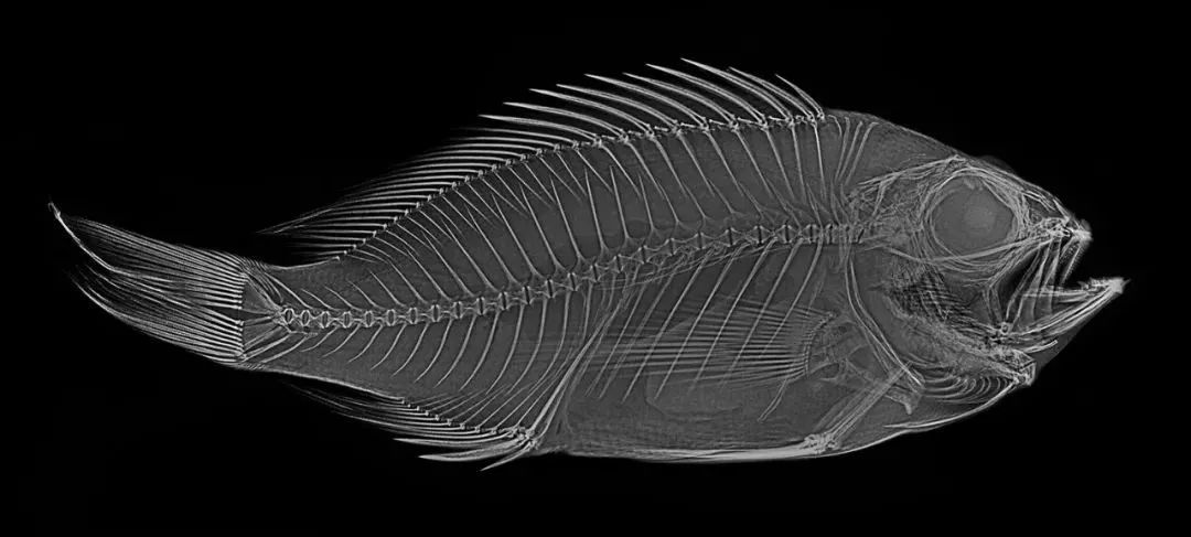 看完这些鱼刺引发的大病才明白被卡过喉咙的自己有多幸运