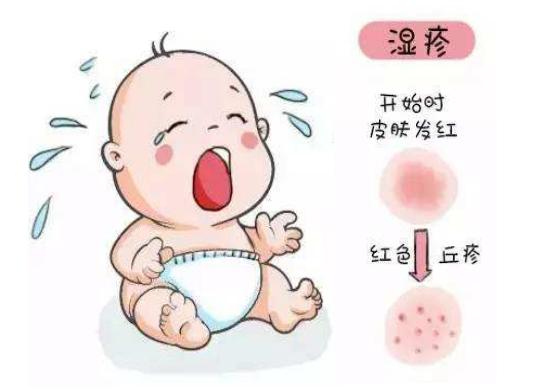 溼疹病因複雜,易發於兒童,尤其是2歲以下的嬰幼兒.