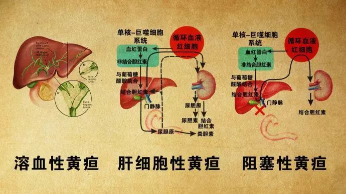 肝功能檢查不會看醫生手把手教你看懂化驗單