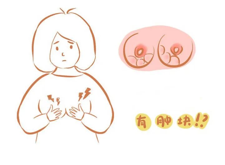 乳腺癌導致的變化,如乳房不對稱隆起樣改變,乳頭或皮膚凹陷,皮膚橘皮