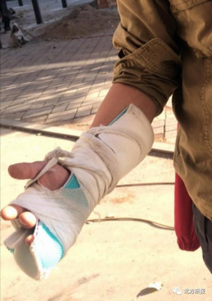 劝阻他人张贴小广告 呼和浩特一男子手指被掰骨折