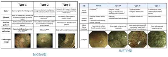胃息肉山田分型图片图片