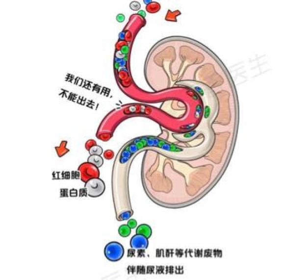 特色技术降氮排毒液结肠透析帮您延缓慢性肾衰进展