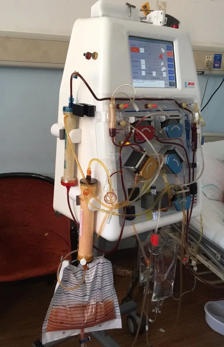 危重患者的神器我院成功开展双重血浆置换技术