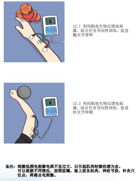 我们来总结主动上肢牵伸运动,手功能训练,神经肌肉电刺激促进治疗