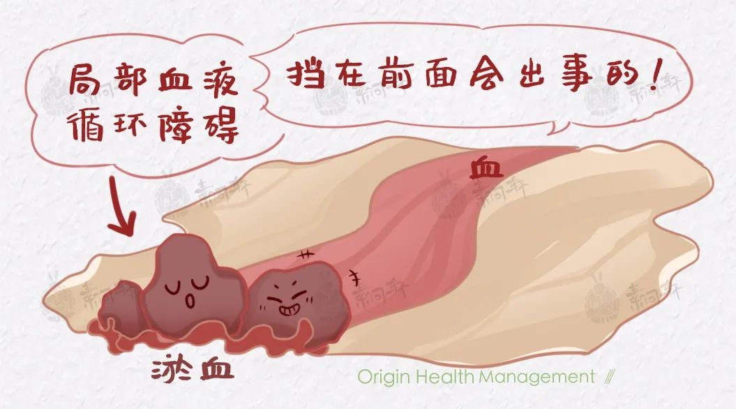 身体有瘀血，5个部位会“说话”，不要等到重病才发现