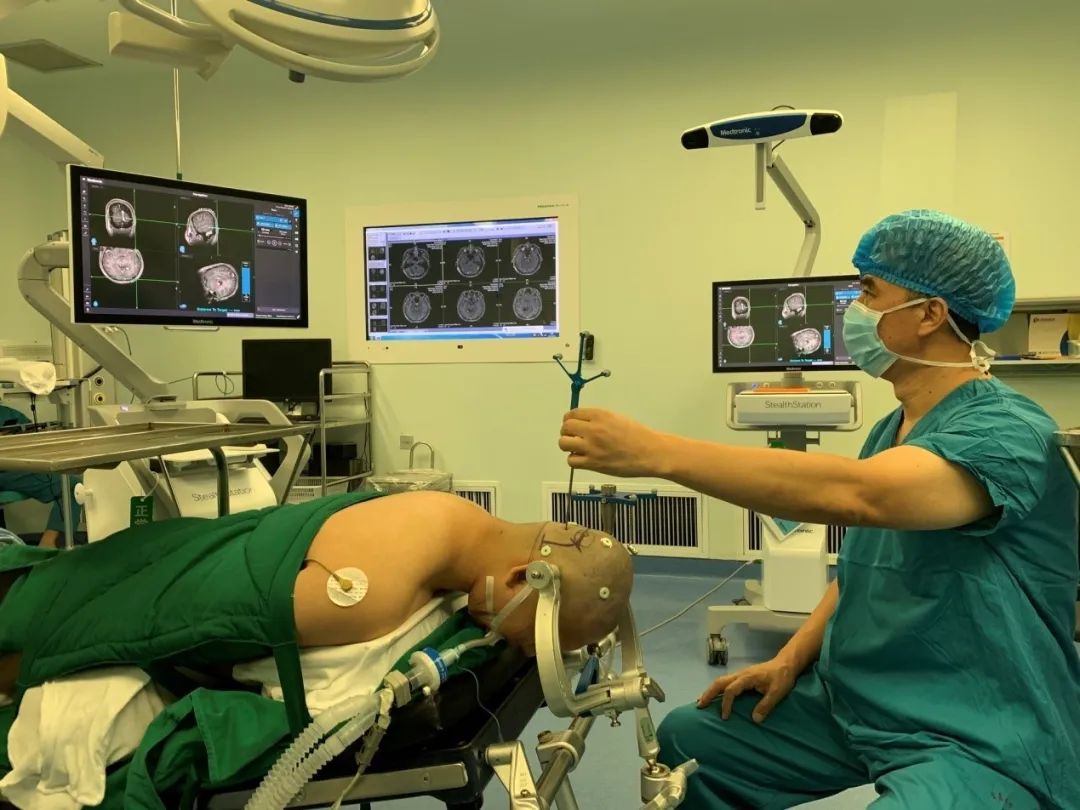 前沿技术丨青大附院神经外科神经导航手术突破100例