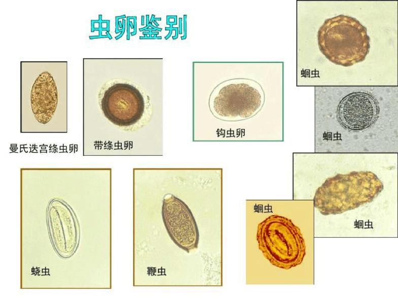 常见的人体寄生虫虫卵形态鉴别在病原学诊断方法无法实现的前提下,用