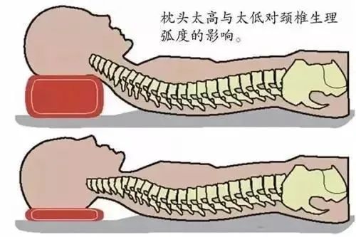 因為頸動脈從頸椎中橫穿而過,如果頸椎出了問題,頸動脈就會受到很大