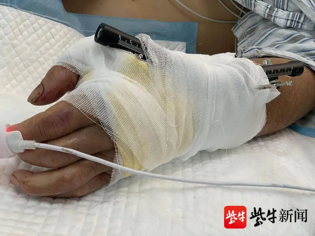 8小时40分钟断腕重生