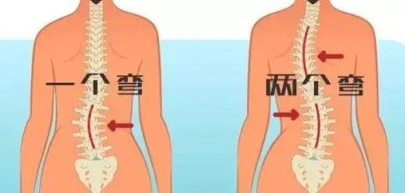 万万没想到这个病已成为青少年成长杀手