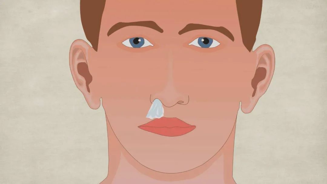 54岁女子查出鼻咽癌,咸菜,咸鱼要少吃