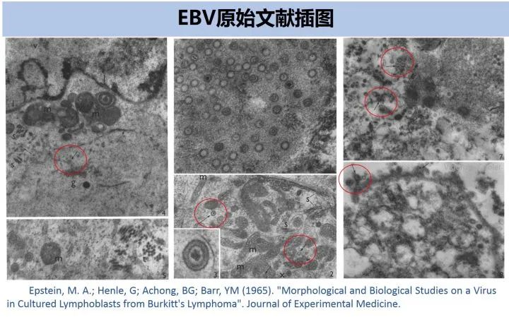 eb病毒结构图图片
